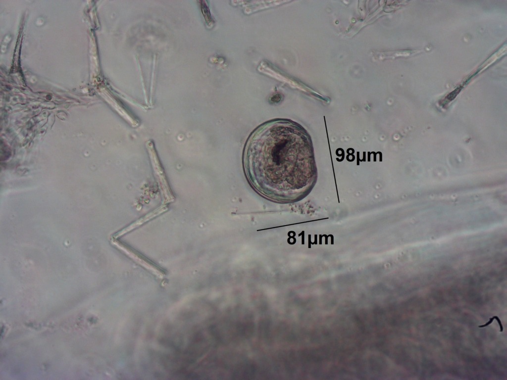 zebra mussel in its larval form (otherwise known as a veliger) under a microscope.