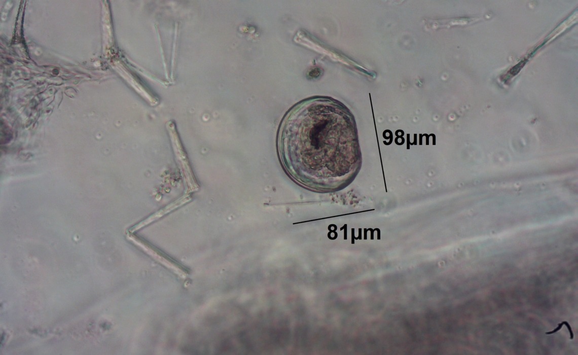 zebra mussel in its larval form (otherwise known as a veliger) under a microscope.