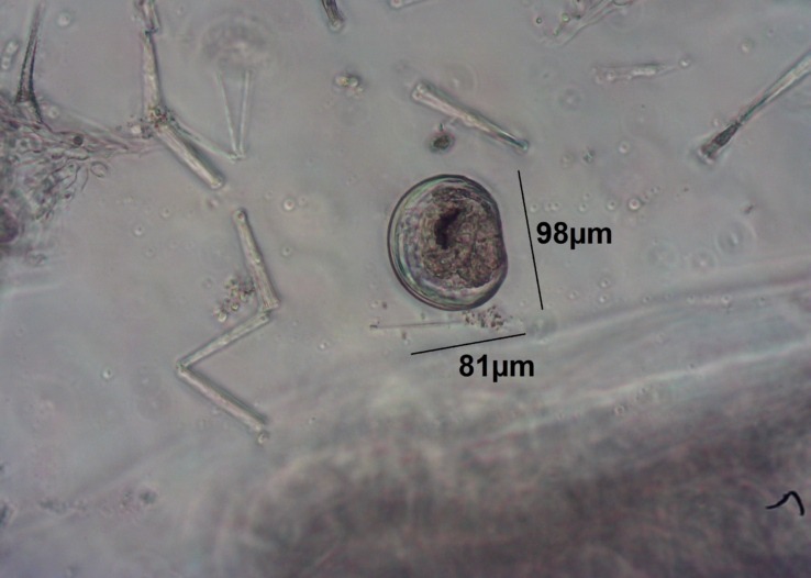 zebra mussel in its larval form (otherwise known as a veliger) under a microscope.