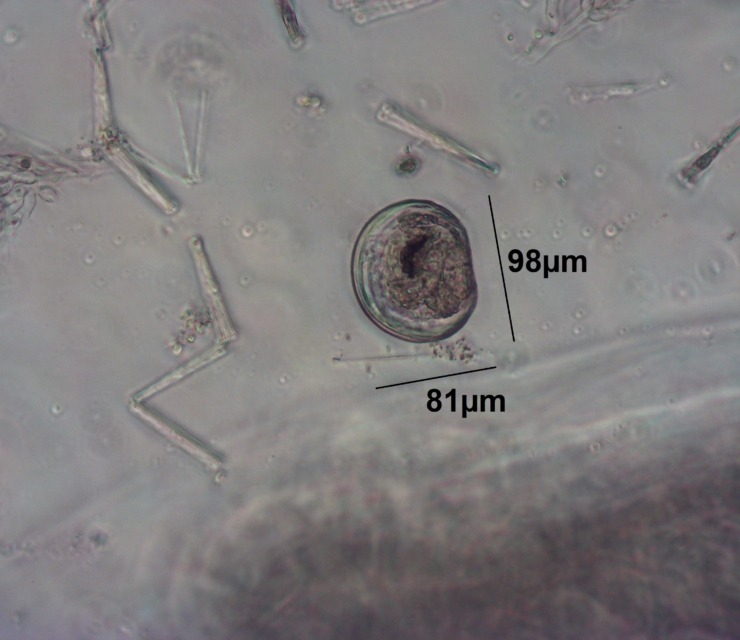 zebra mussel in its larval form (otherwise known as a veliger) under a microscope.